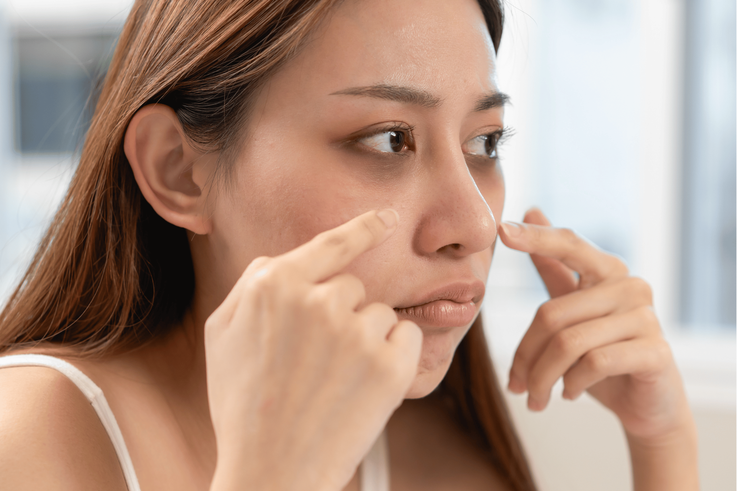 Filler vs Laser: Which to Choose for Dark Eye Circles?